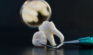 cosmetic dentistry in Shreveport LA