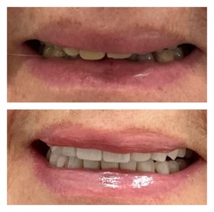 NY Smile Destination