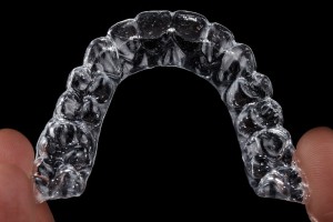 Invisalign Aligner