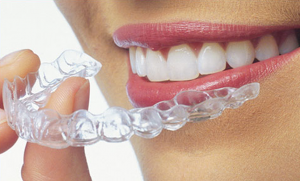 Clear Aligners Market