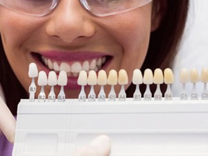Press release image for dental veneers services