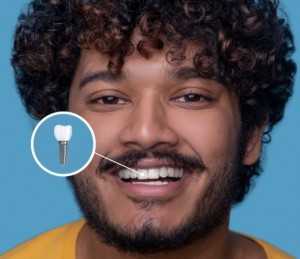 dental implants in ahmedabad 678x584