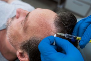ReBalance PRP hair loss treatment