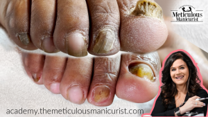 STAR NT Meticulous Manicurist Online Nail Academy