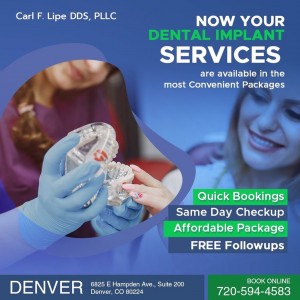 Discover the ease of our Dental Implant Services 5mp