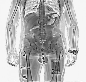 CLEARPASS CI portable body scanner2