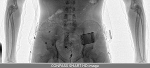 Full-body screening technology