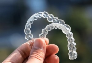 Advantages of invisalign aligners