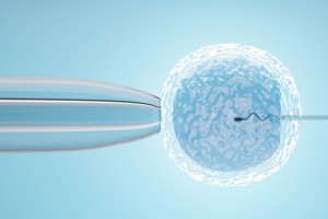 Fertility Specialist in Noida