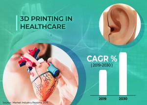 3D Printing in Healthcare Market Overview, Forecast By 2030: 3D Systems, Strategy’s, SLM Soluti