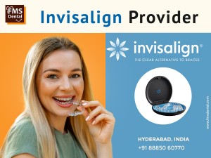 Best Invisailgn Provider in Hyderbad