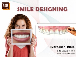 Smile Designing Surgery in Hyderabad at FMS Dental