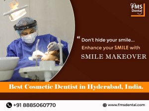 Smile Makeover Treatment in Hyderabad