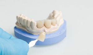 No More Waiting Weeks: Perfect Smile Tulsa Offers CEREC® One-Visit Crowns