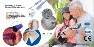 A New Hope for Patients with Chronic wounds and may  Facing Amputation 