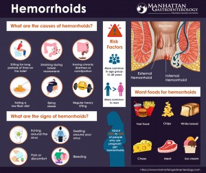 Hemorrhoids