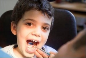 Kid s Dentistry Bonham Dental Arts Seminole FL
