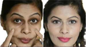 Richard Haxton’s Facial Sculpting Named Best Beauty Treatment 2024