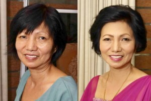 Richard Haxton’s Facial Sculpting Named Best Beauty Treatment 2024