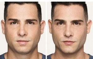 Richard Haxton’s Facial Sculpting Named Best Beauty Treatment 2024