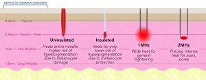 RF Microneedling Depth Chart