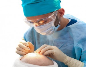Panacea Global Hair & Skin Services : Hair Transplant Clinic in Delhi for Individuals and Families