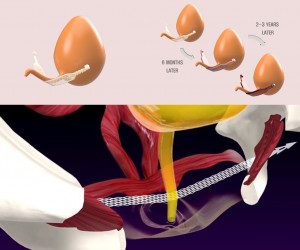 TissueDerm BIO-TOT: Biodegradability