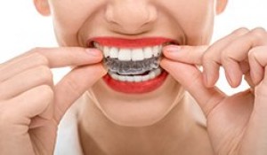 EDGW: “The Top Invisalign Specialist In Connecticut!”