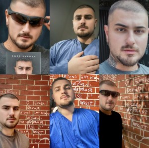 How Amy Winehouse Inspires the New Identity of Emre Bardan as Atakan now recovering struggles in the Ward