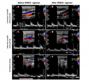 Blood flow velocity and spectrum measurement based on Colour Doppler Ultrasound.