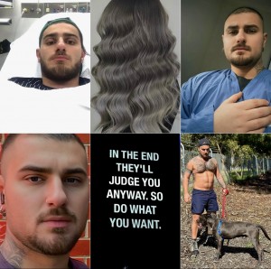 “Help Us Heal Together: Support Glamhairartist Atakan”