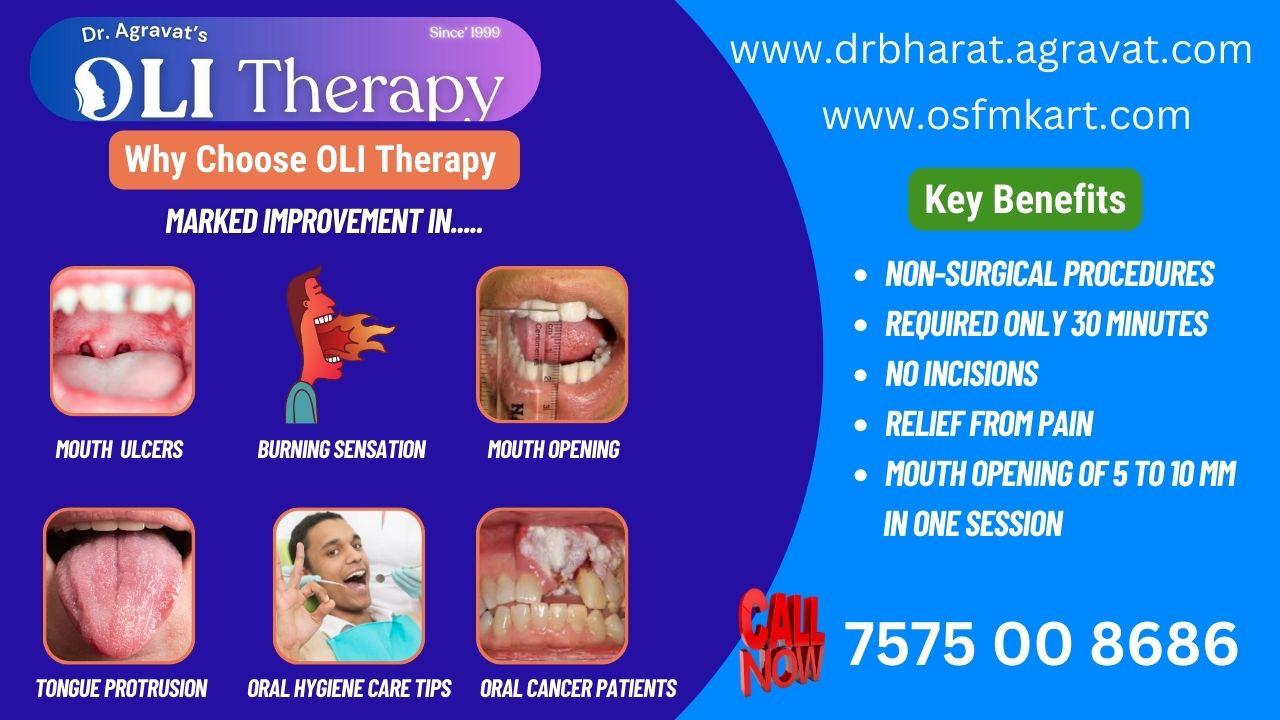 Massive Breakthrough in OSMF Treatment — Dr.Agravat’s OLI Therapy famous and popular