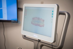 iTero Element Intraoral Scanner at UNO DENTAL SAN FRANCISCO