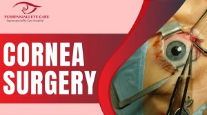 Cornea Surgery