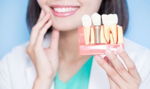 DENTAL IMPLANTS IN WINCHESTER VA