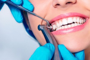 dental cleanings ottawa