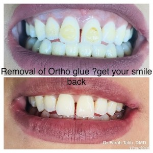 By Dr Farah Talib, DMD