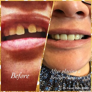 By Dr Farah Talib, DMD