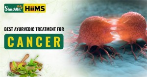 Best Ayurvedic Treatment for Cancer