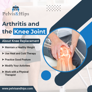 Knee Joint