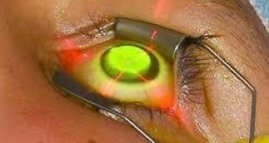 ccl r36p10qmm3fmkot3xgb4mrki8p6jeqxk1rlk7wlv7s