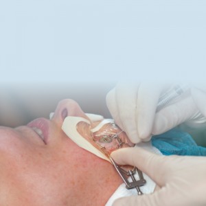 Corneal Transplant mob