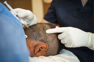 Best FUE Hair Transplant clinic in Mira Road