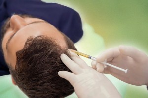 PRP hair treatment in Malad