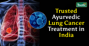 Lung Cancer Treatment in India