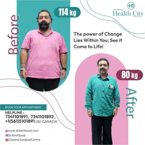 Best Bariatric Surgeon in Haryana