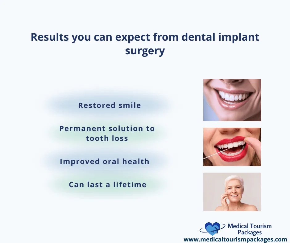 Dental  Benefits of Dental Implants