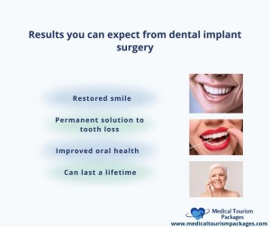 Dental - Benefits of Dental Implants