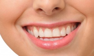 TEETH WHITENING SUGAR LAND
