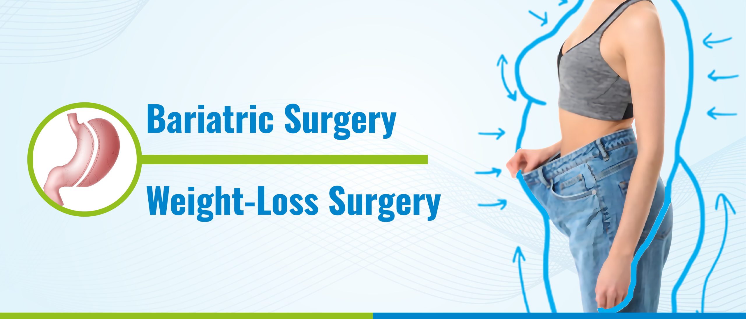 Bariatric Surgery scaled Bariatric Surgery scaled
